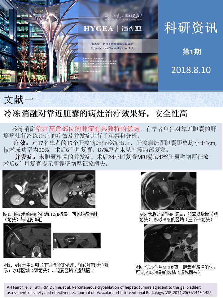 【海杰亞科研資訊】第1期——肝、肺癌消融